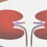 Kidney
