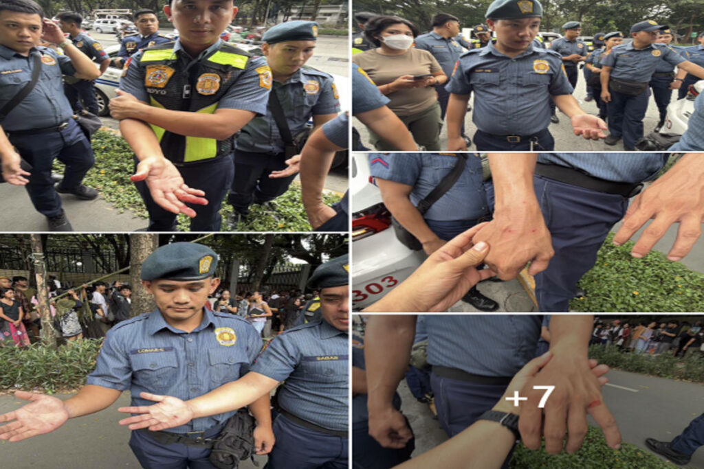 QCPD1